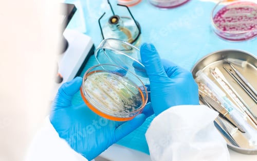 Preview: Examine bacteria in petri dishes in the laboratory. Selective focus.