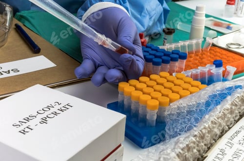 Preview: Scientist Investigates Medical Treatment for Covid-19 Coronavirus in Hospital, Spain
