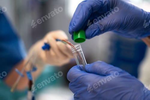 Preview: Scientist placing blood sample into test tube during medical research experiment