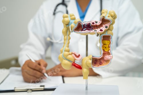 Preview: Intestine, appendix and digestive system, doctor holding anatomy model