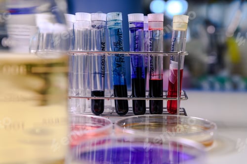 Preview: Closeup shot of laboratory test tubes with different substances for coronavirus research