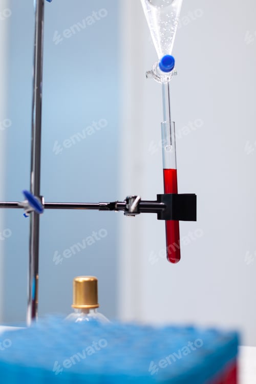 Preview: Blood test tube standing in medical equipment ready for biochemistry infection experiment