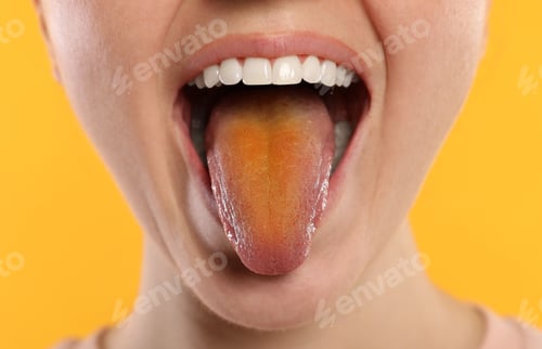 Preview: Gastrointestinal diseases. Woman showing her yellow tongue on color background, closeup