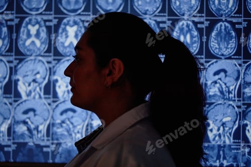 Preview: Profile of Female Doctor Standing against Screen with Brain MRI Scan in Hospital