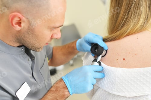 Preview: dermatologist examines neoplasms on the patient's skin using a special dermatoscope device
