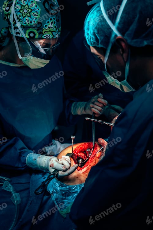 Preview: Surgeons Perform Invasive Procedure in Hospital Operating Room