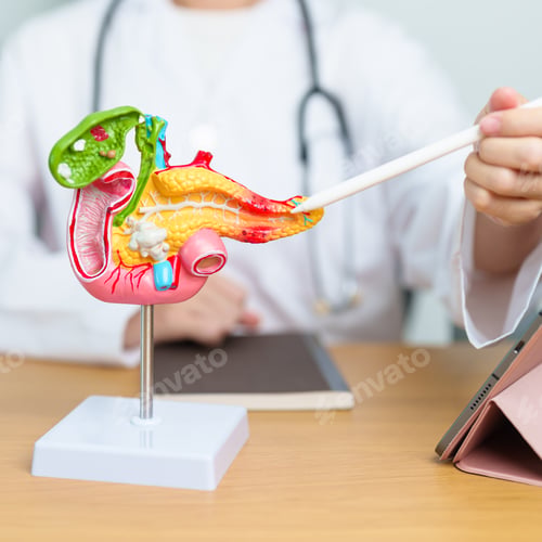 Preview: Doctor with human Pancreatitis anatomy model with Pancreas
