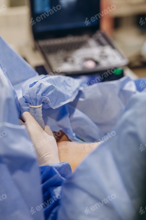 Preview: Doctor surgery foot Suture,Percutaneous transluminal angioplasty ,Vascular bypass blood vessel