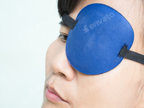 Visualização: Mulher Tapa-olho Cirurgia de pterígio Proteção da saúde ocular