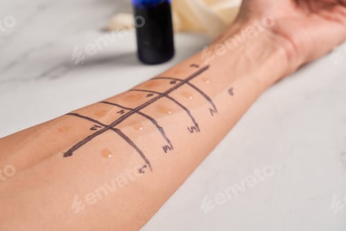 Preview: Doctor making allergy skin test on patient's hand in clinic
