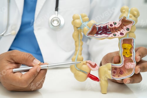 Preview: Intestine, appendix and digestive system, doctor holding anatomy model
