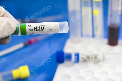 Preview: Closeup shot of an empty blood test sample tube in doctors hand with white gloves