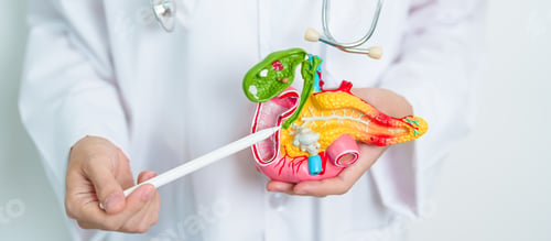 Preview: Doctor with human Pancreatitis anatomy model with Pancreas