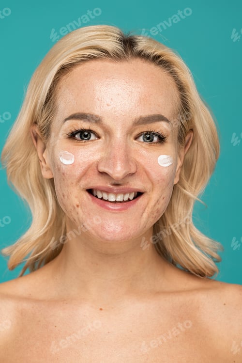 Preview: happy woman with skin issues applying treatment cream on face isolated on turquoise