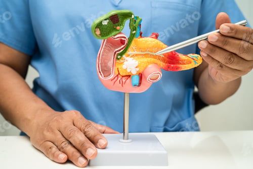 Preview: Pancreatitis, pancreatic cancer, Asian doctor with pancreas, gallbladder and bile duct human