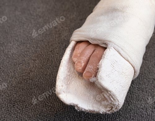 Preview: Teenager boy with injured broken leg in a plaster cast on the bed at home with crutches