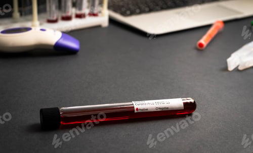 Preview: Test tube containing a blood sample test tube for Covid-19 coronavirus analyzing