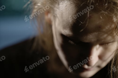 Preview: Bruises on forehead. Domestic violence