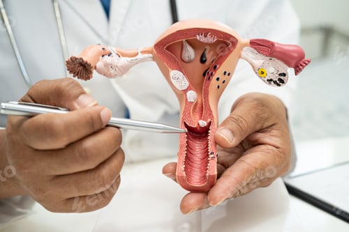 Preview: Uterus, doctor with anatomy model for study diagnosis and treatment in hospital.