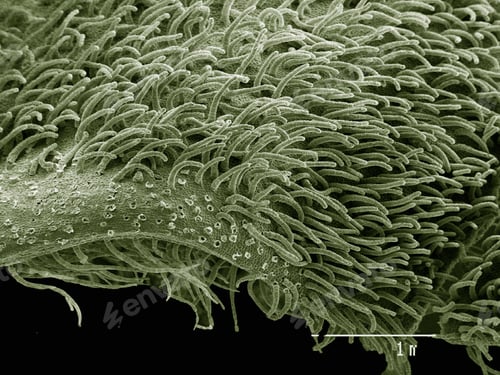 Preview: A closeup view of microscopic structures resembling a dense forest under magnification.