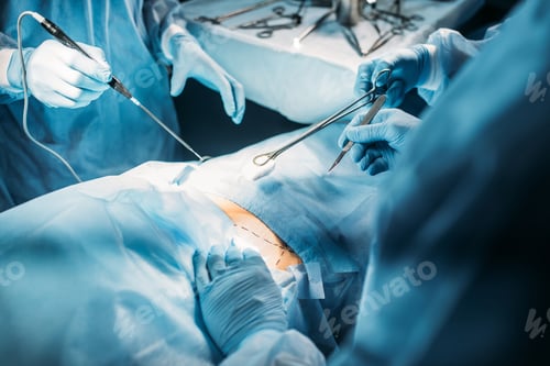 Preview: Surgical Operation with Instruments in Hospital Room