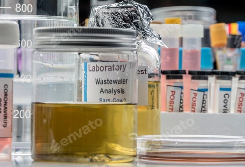 Preview: Wastewater samples, analysis of sars-cov-2 virus in patients infected by human coronavirus 229E