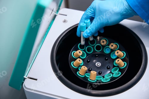 Preview: Laboratory worker places test tubes with biomaterial into special apparatus