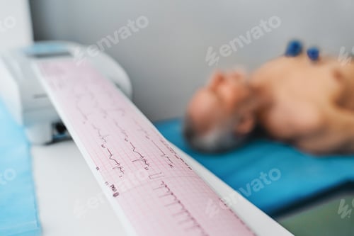 Preview: ECG. Cardiogram printout on male patient background