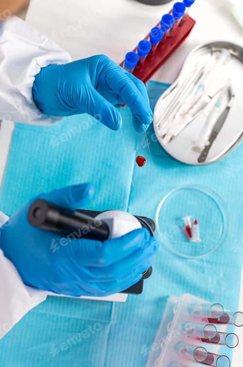Preview: examine blood in the laboratory. Selective focus.