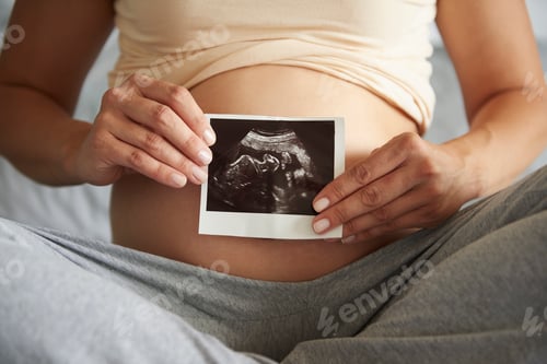 Preview: The new baby is coming so soon