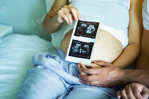 Preview: Closeup of pregnant woman with ultrasound film of her baby on bed.