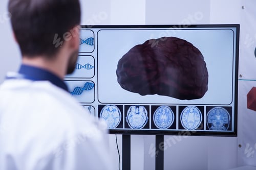 Preview: Young doctor checking a brain after nerve surgery