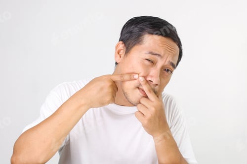 Preview: Man with Fingers Pointing to Blemish on Face