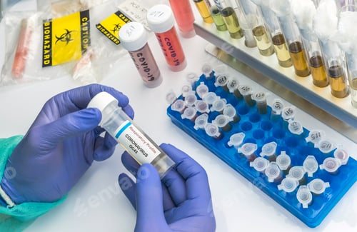 Preview: Scientist holds vial with sample of coronavirus OC43 in a specialized laboratory, conceptual image