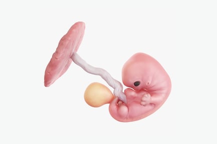 Preview: Week 7 Human Fetus with Placenta and Umbilical Cord Anatomy