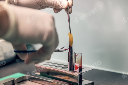 Preview: Platelet-rich fibrin application