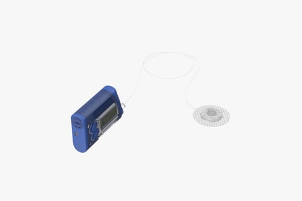 Preview: Medical Insulin Delivery Pump System
