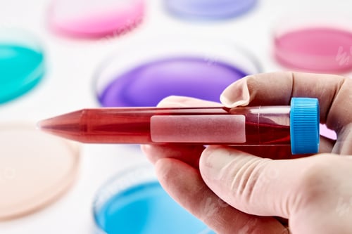Preview: Blood sample in a plastic test tube on the background of Petri dish with colorful liquids or media