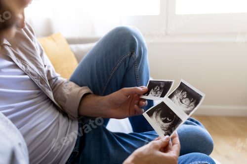 Preview: Unrecognizable couple looking at baby ultrasounds together.