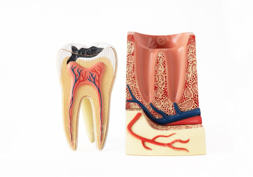 Tooth Anatomy Model Showing Decay and Dental Health