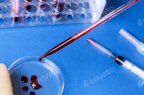 Preview: Pipette and petri dish with blood test tube in a medical analysis hospital laboratory