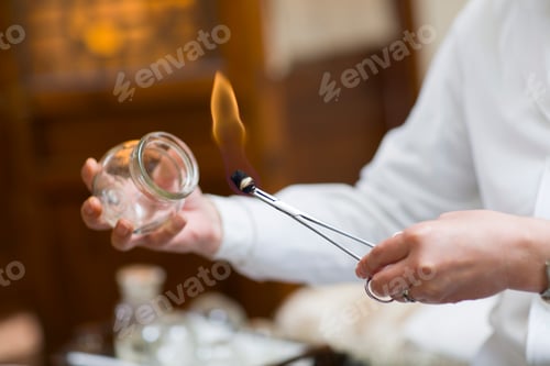 Preview: Senior Chinese doctor performing massage cupping therapy