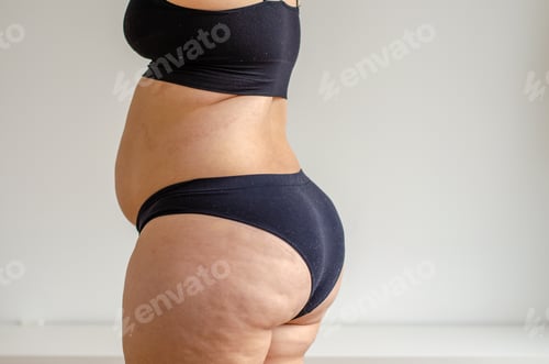 Preview: Overweighted woman wearing bikini seen from back