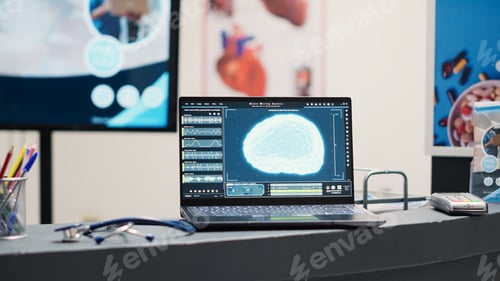 Preview: Laptop showing neural system on desk