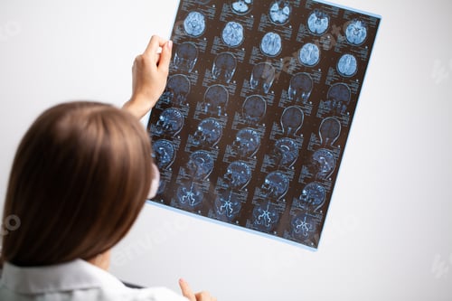 Preview: Beautiful female radiologist looking at the MRI scan images