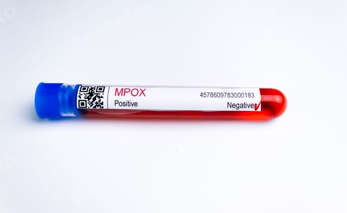 Preview: Up of laboratory flask containing blood sample for testing of Monkeypox virus, on white background