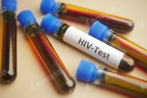 Preview: HIV blood test tube on color background