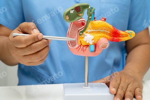 Preview: Pancreatitis, pancreatic cancer, Asian doctor with pancreas, gallbladder and bile