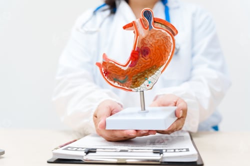 Preview: Doctor Holding Anatomical Model of Stomach