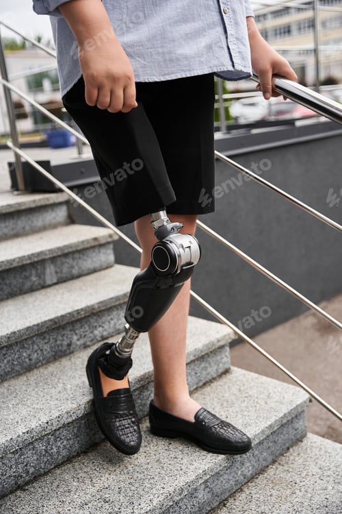 Preview: Young man with prosthetic leg navigating outdoor stairs in casual shorts and loafers